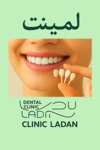 قبل و بعد از لمینت دندان برای اصلاح رنگ و فرم لبخند